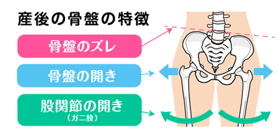 産後の骨盤の特徴